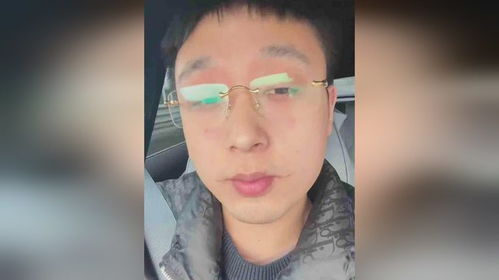 烧烤烫出微笑唇，美食与肌肤的意外邂逅