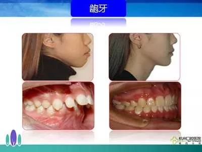 以牙还牙续集，免费观看与深度解析