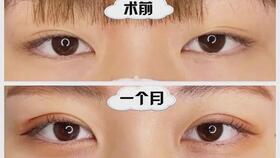整容作家，免费短剧的魅力与启示