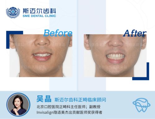 2两部_2两部嘴巴旁边突然间抽一下筋马上恢复是什么原因