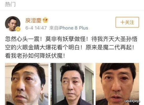 黄金左眼_黄金左眼短剧免费观看